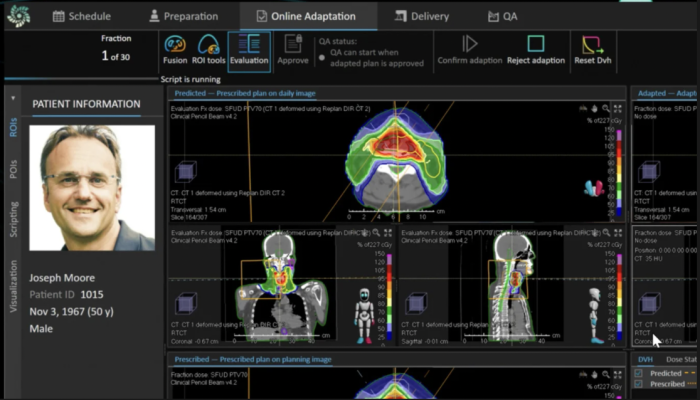 Latest innovations in RayStation, RayCare and RayIntelligence to